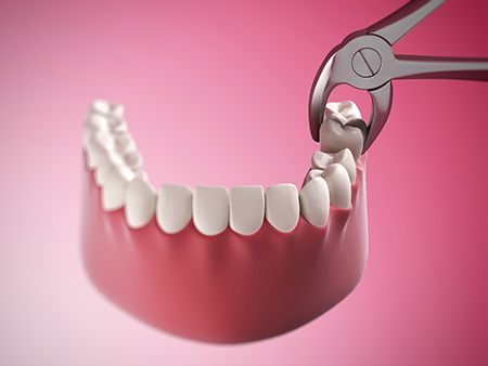 Lakeland Periodontics   Implant Dentistry
